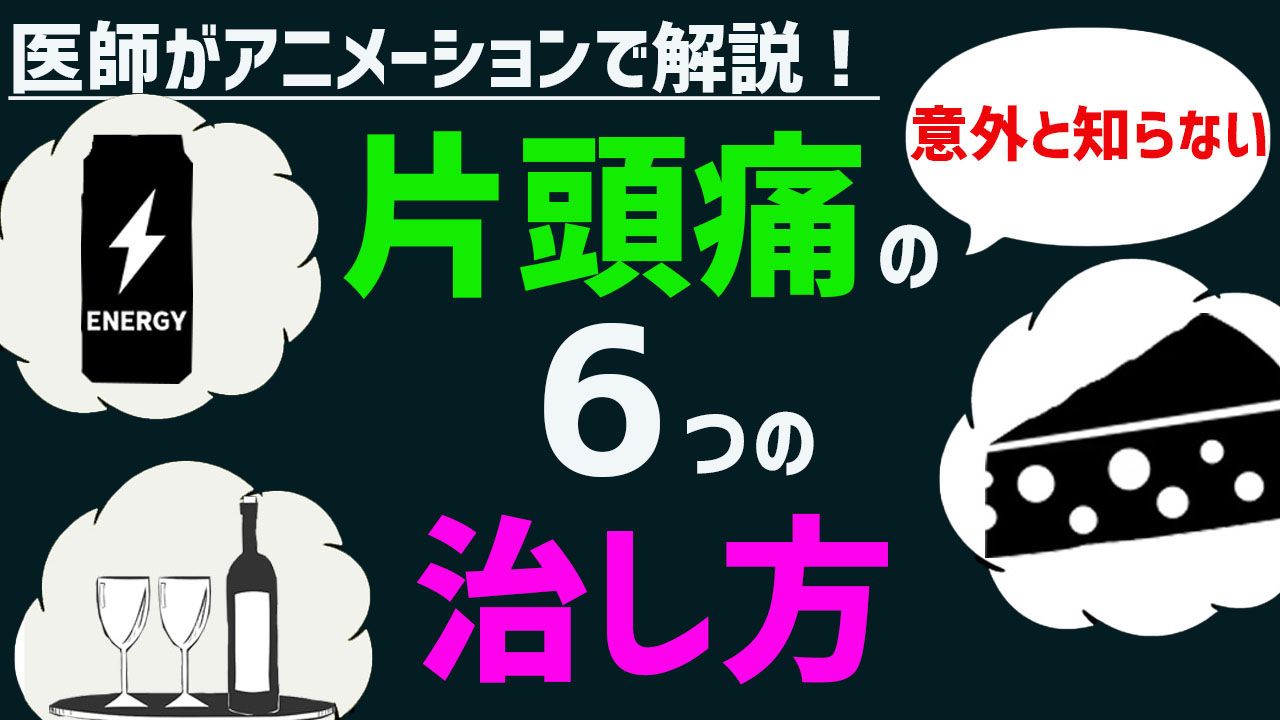 片頭痛（偏頭痛）の症状・原因とは？６つの治し方・対処法を医師が徹底解説！