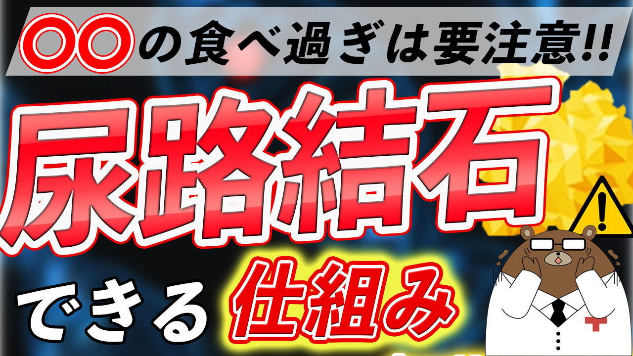 尿路結石の原因とは？初期症状・治療や食事との関係、予防法まで医師が徹底解説！