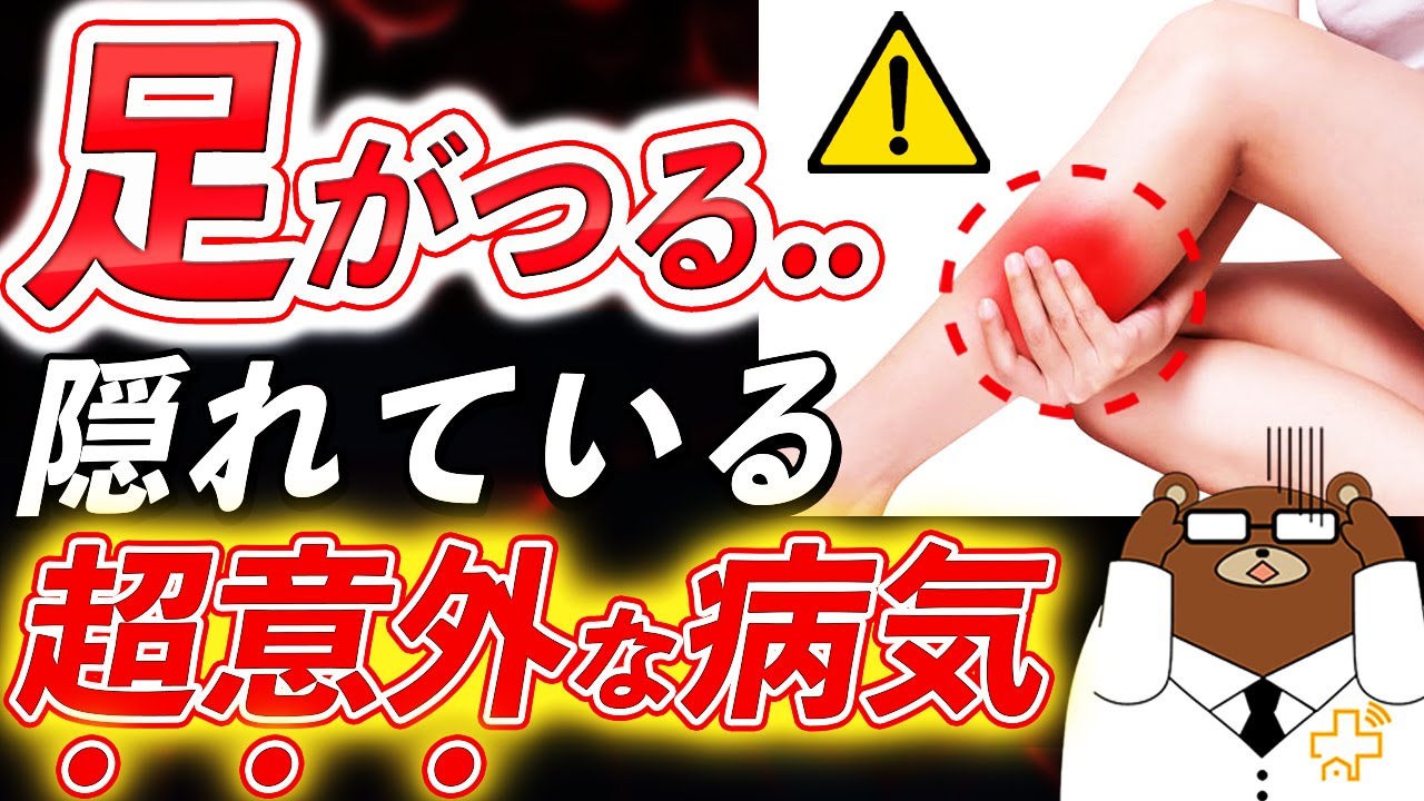 足がつる（こむら返り）症状は意外な病気の前兆？見逃せない兆候を医師が完全解説