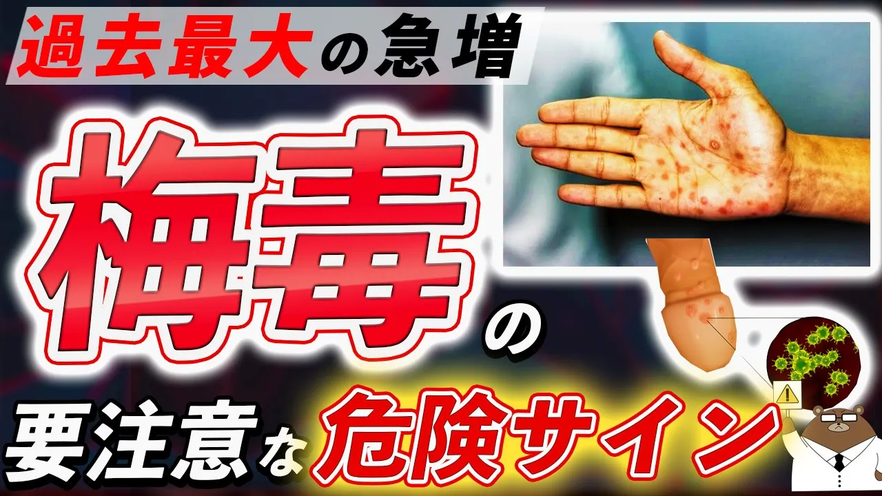 梅毒とは？症状・原因・薬の治療法・予防法について医師が完全解説！