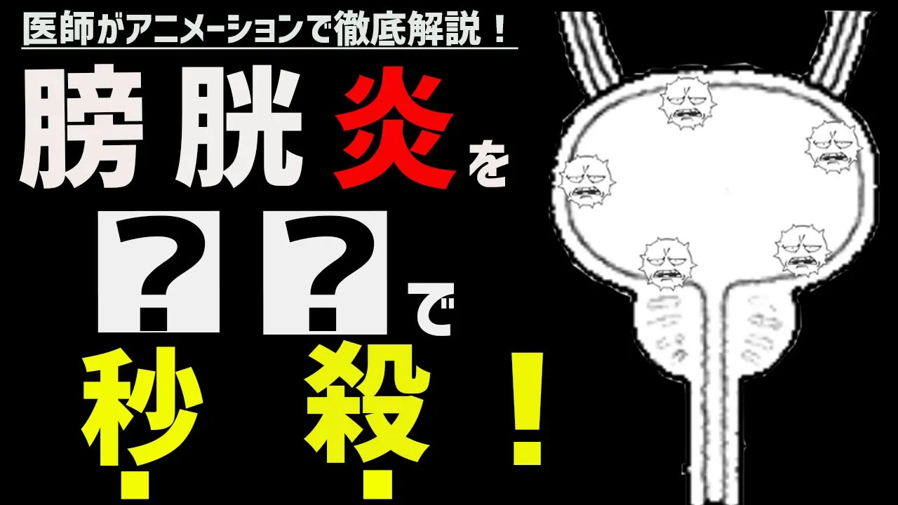 膀胱炎の治し方・一晩で治す方法について医師が解説