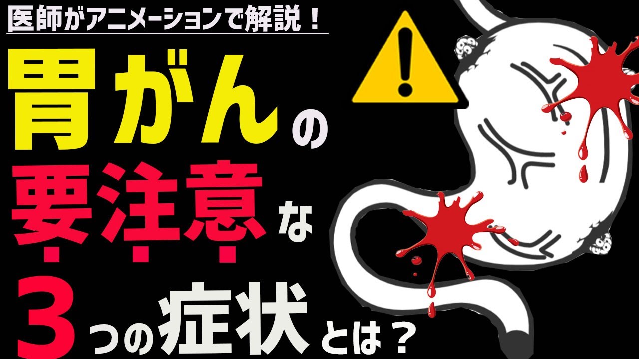 胃がんの初期症状をチェック！原因や胃がん検診についても医師が徹底解説！