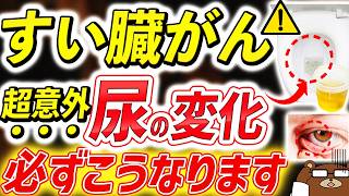 膵臓がんの初期症状チェック！見逃してはいけない兆候を医師が解説