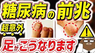 糖尿病の「足」の初期症状。かゆみ・しびれ..意外な症状を医師が徹底解説【写真あり】
