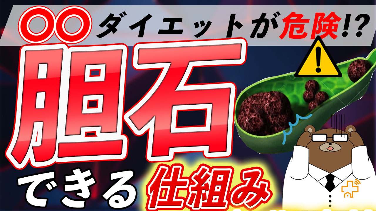 胆石の症状や原因とは？どんな痛み？治療法は？【医師解説】