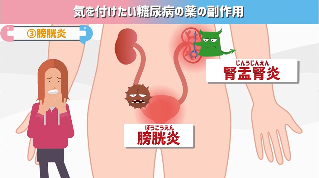 糖尿病 薬 副作用